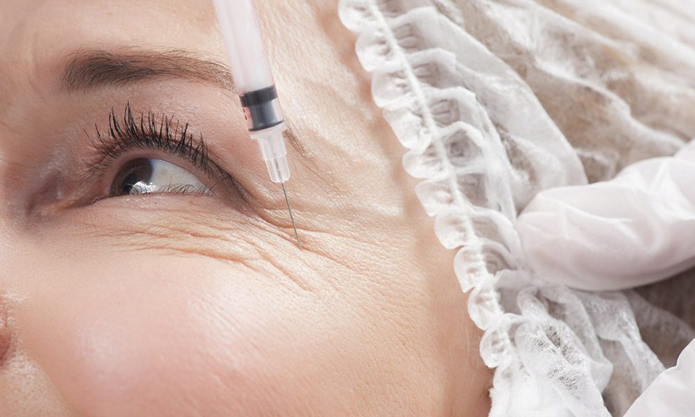 Foto: EYELID AGING