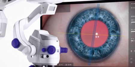 Imagem: Artevo 800: mais precisão e segurança na cirurgia ocular