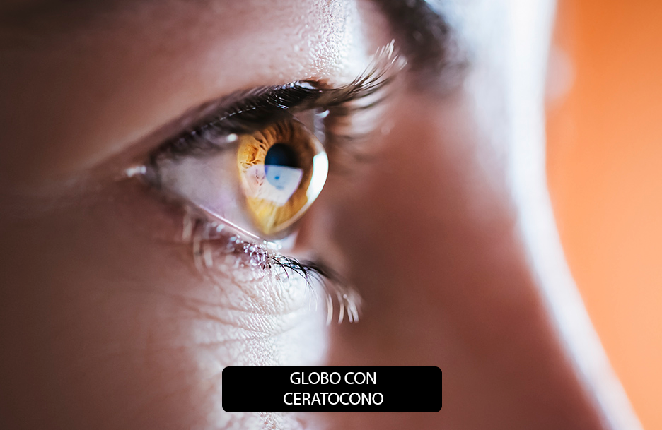 Imagem a direita