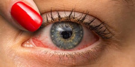 Imagem: Implante Xen: solução inovadora para o tratamento do glaucoma